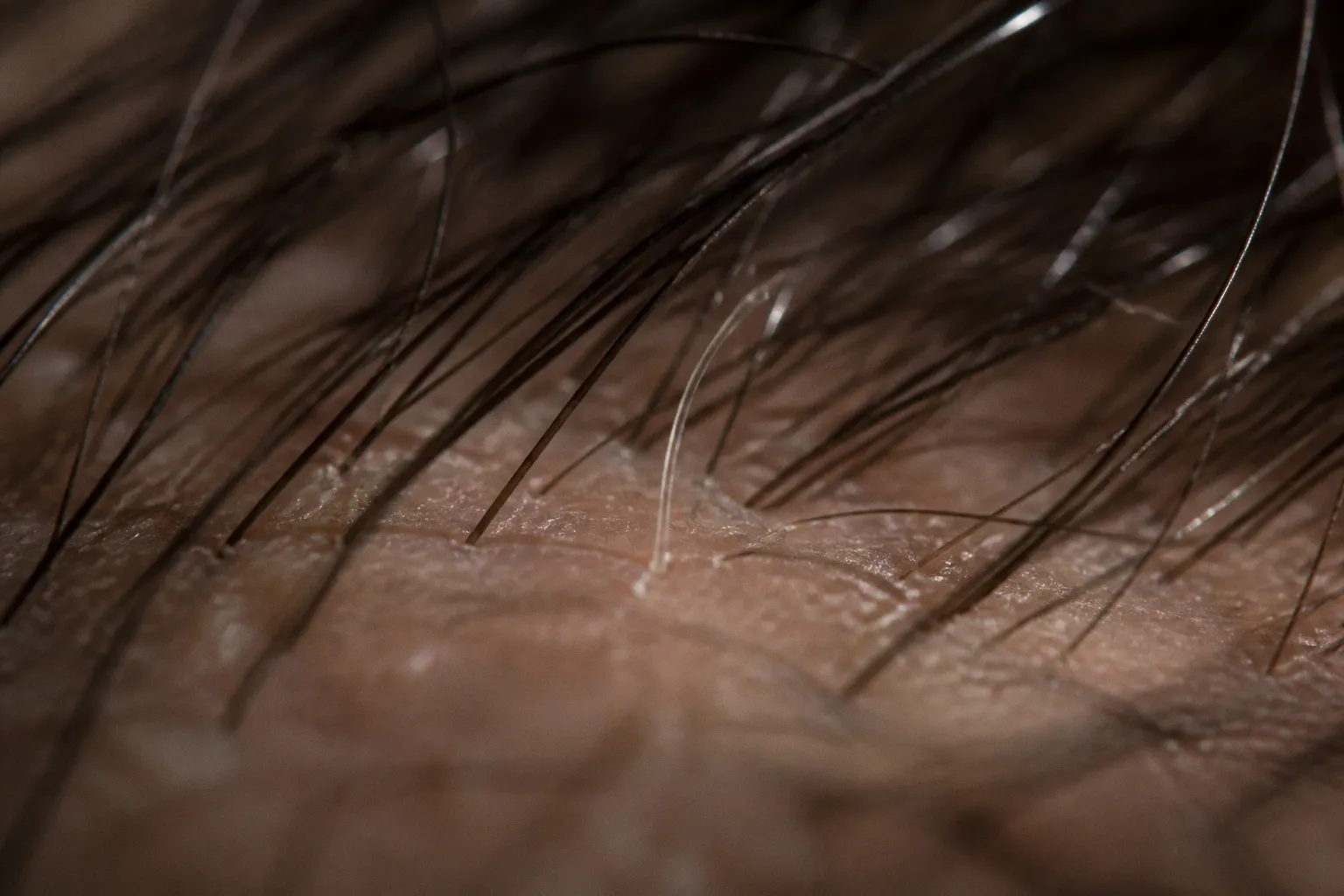 Miniaturizzazione dei capelli: cosa succede al bulbo
